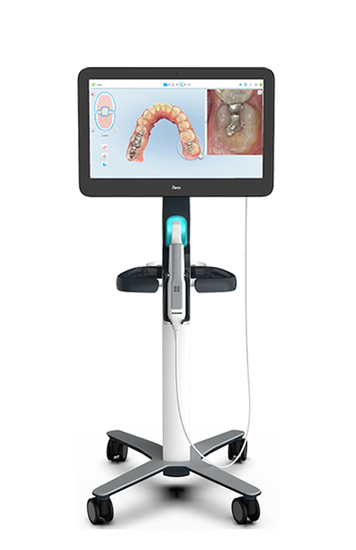 iTero Dental 3D intraoral scanner