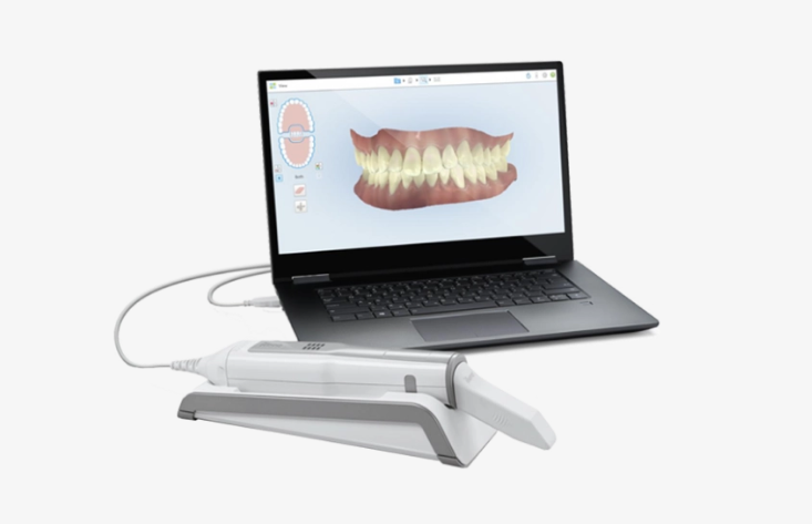 The iTero Element™ Flex intraoral scanner